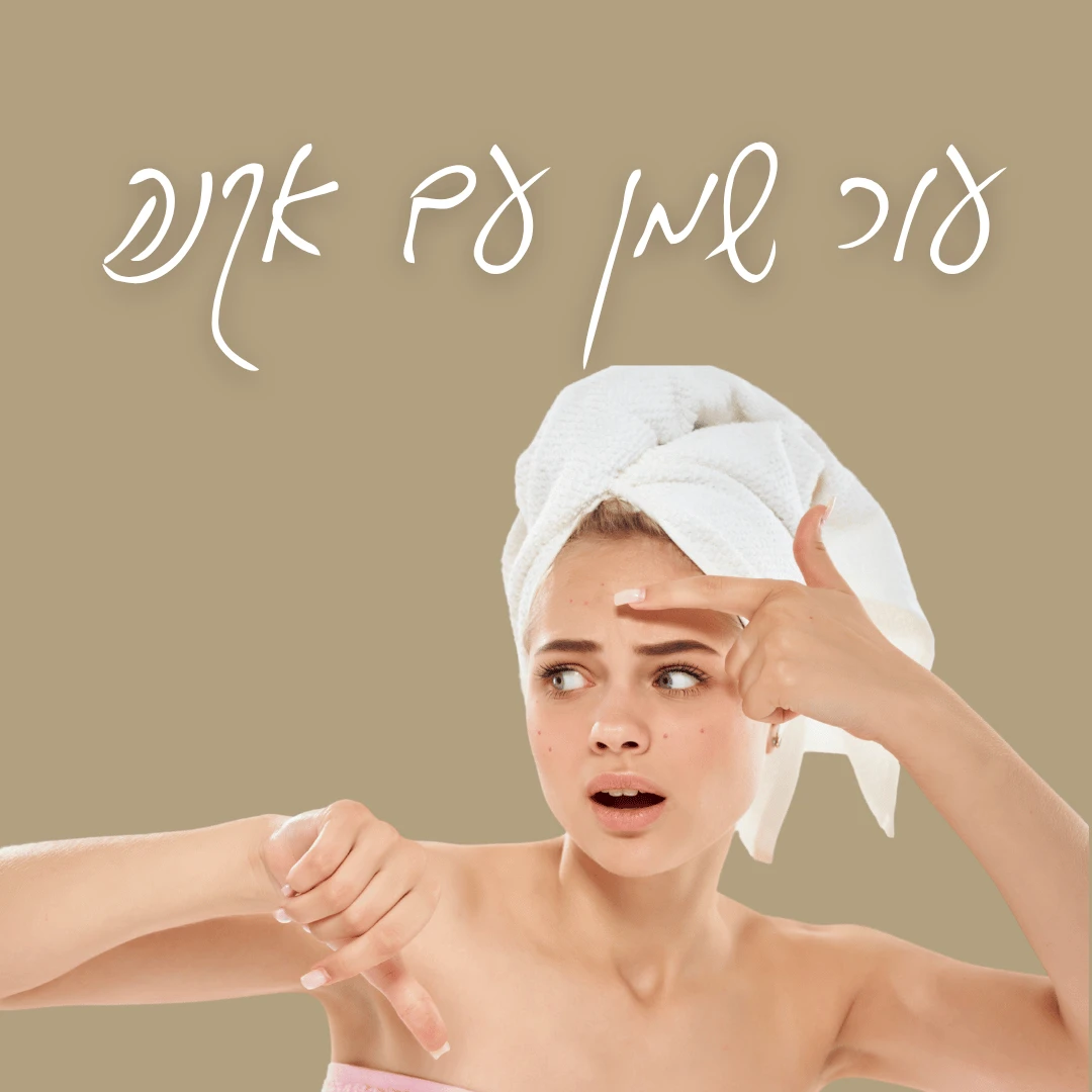 עור שמן עם אקנה